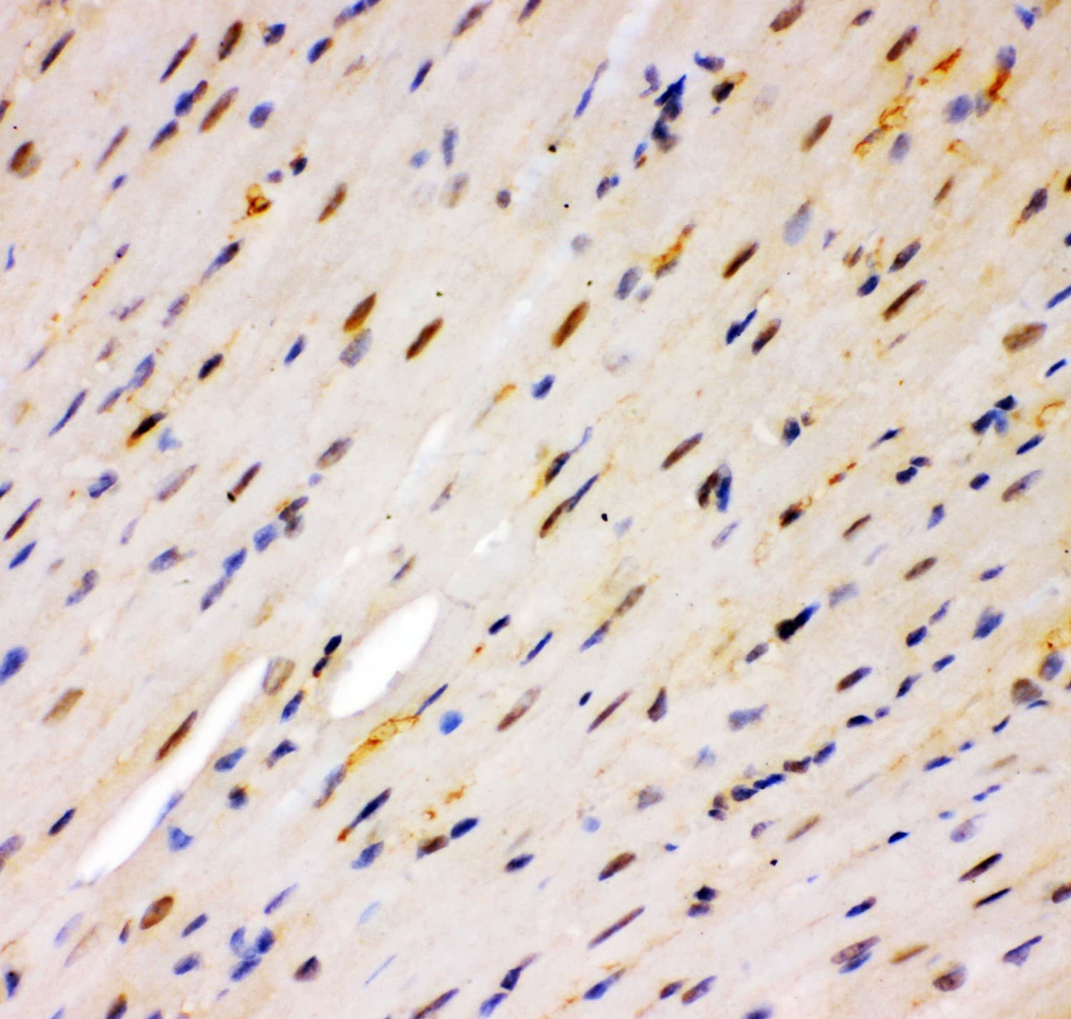 RPS6KA5 / MSK1 Antibody (aa540-665)