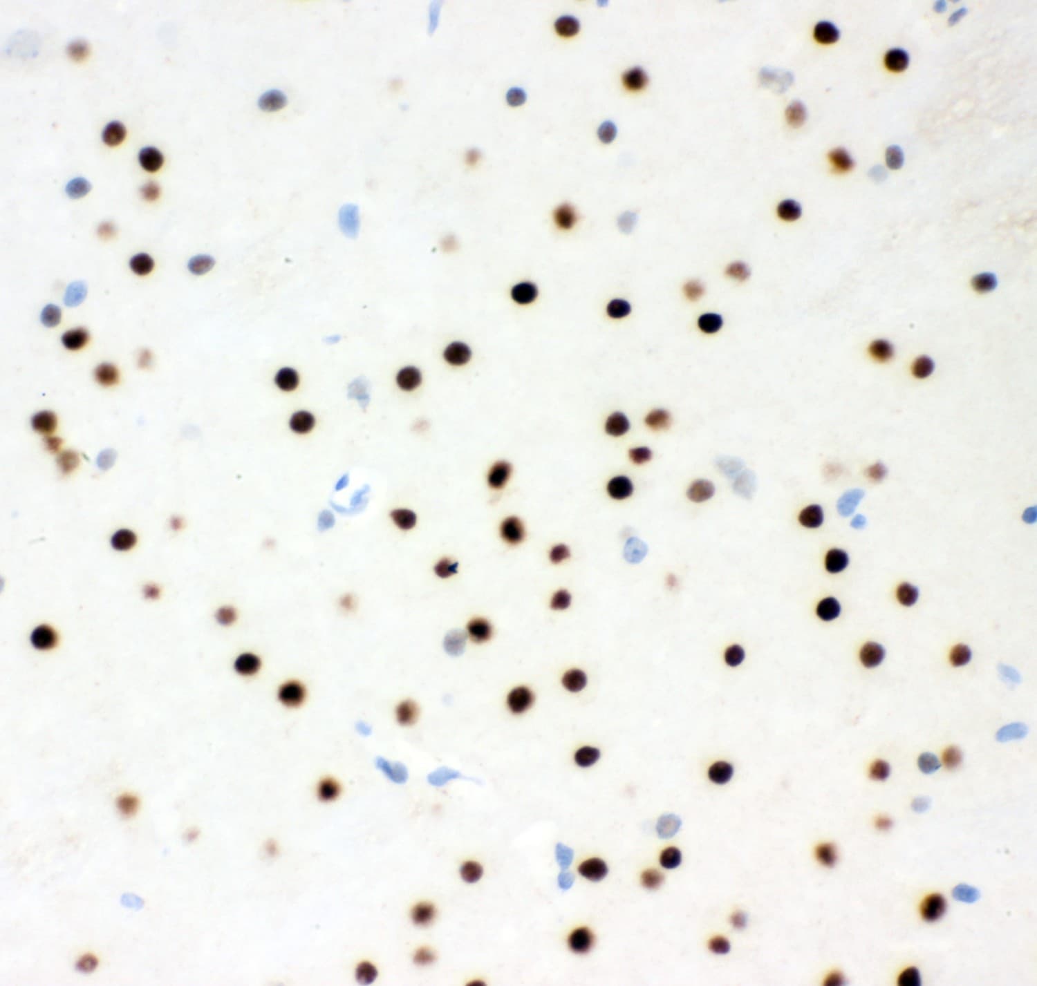 RPS6KA5 / MSK1 Antibody (aa540-665)