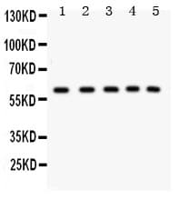 STK11 / LKB1 Antibody (aa62-430)