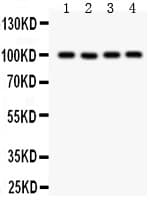 TRPC7 Antibody (aa716-862)