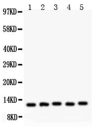 Polyclonal Rabbit anti-Human MIF Antibody (aa2-115, IHC, WB)