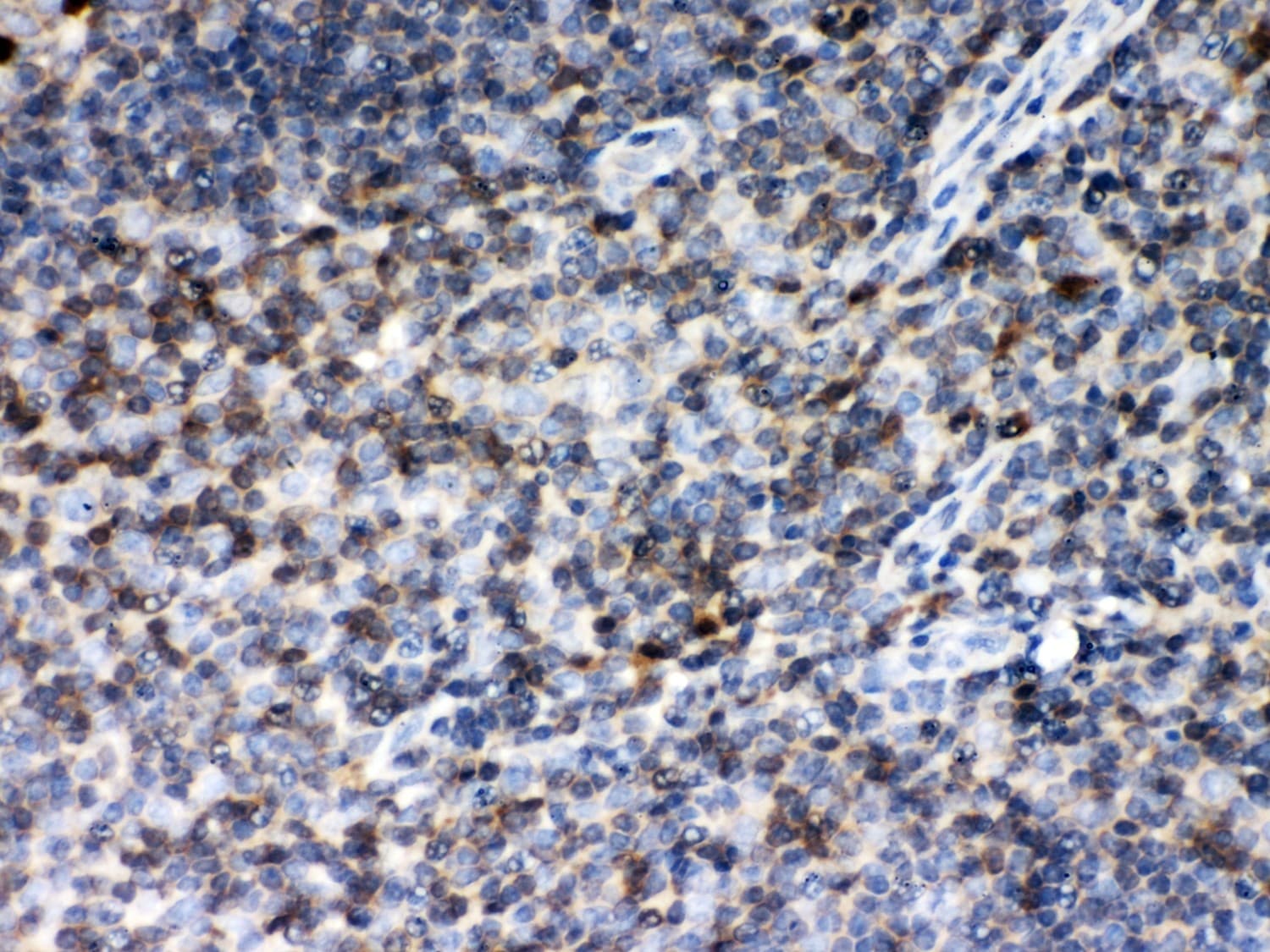 Polyclonal Rabbit anti-Human MIF Antibody (aa2-115, IHC, WB)