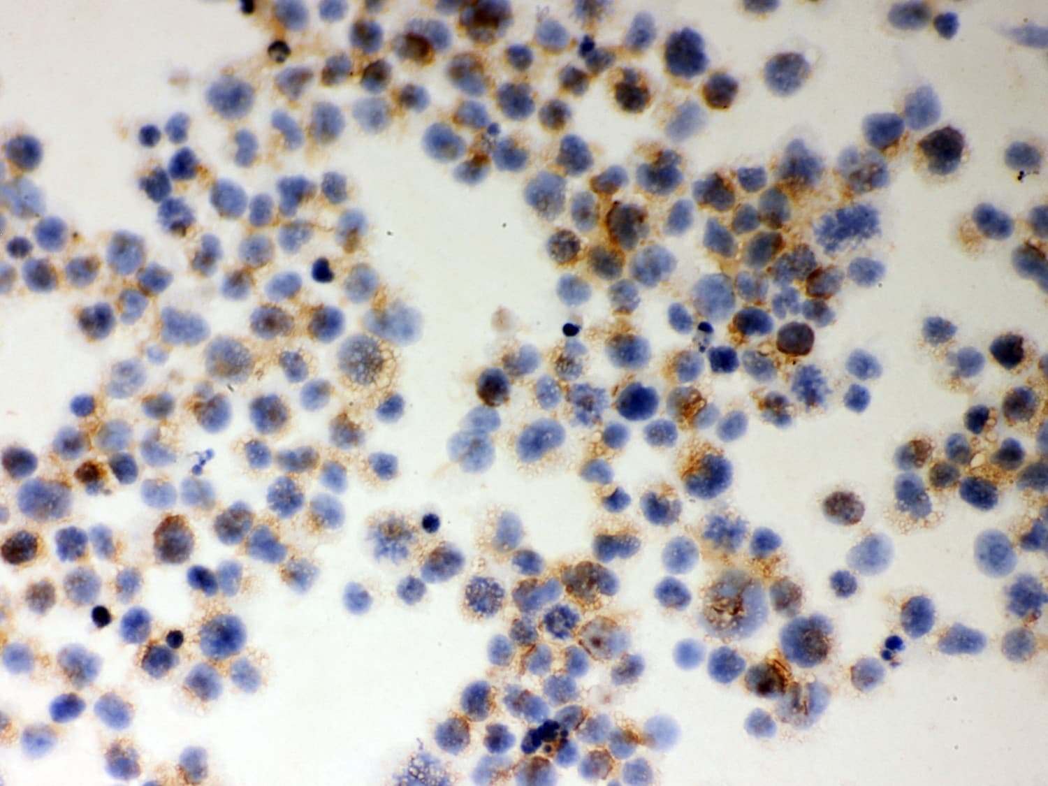 Polyclonal Rabbit anti-Human MIF Antibody (aa2-115, IHC, WB)