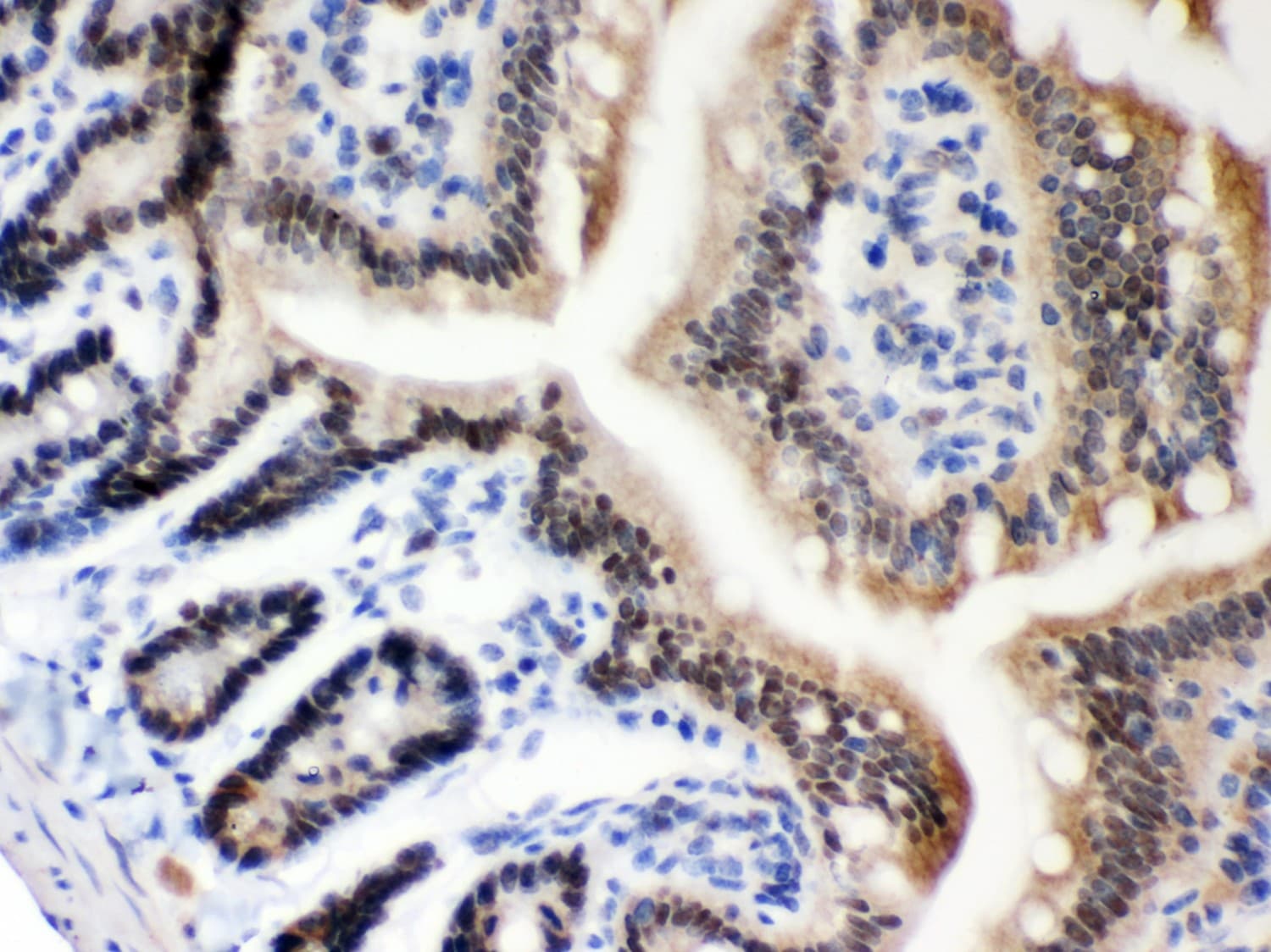 Polyclonal Rabbit anti-Human MSH2 Antibody (aa337-583, IHC, WB)
