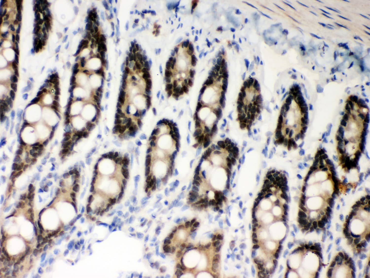 Polyclonal Rabbit anti-Human MSH2 Antibody (aa337-583, IHC, WB)