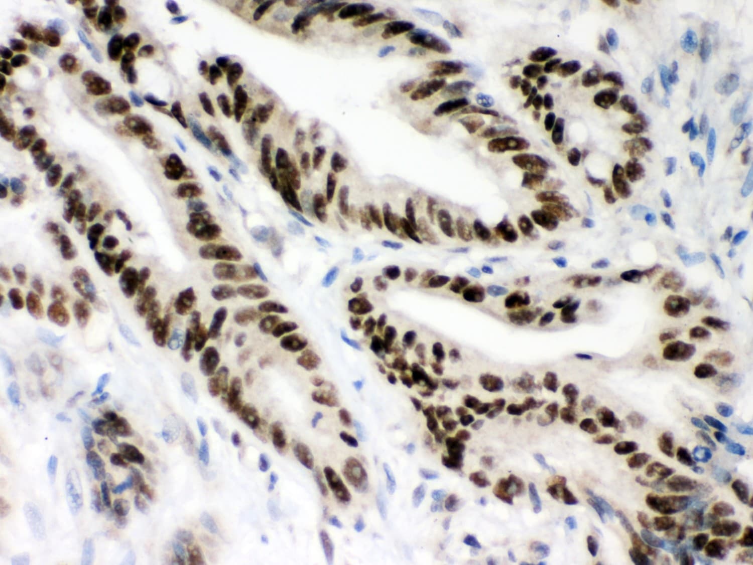 Polyclonal Rabbit anti-Human MSH2 Antibody (aa337-583, IHC, WB)