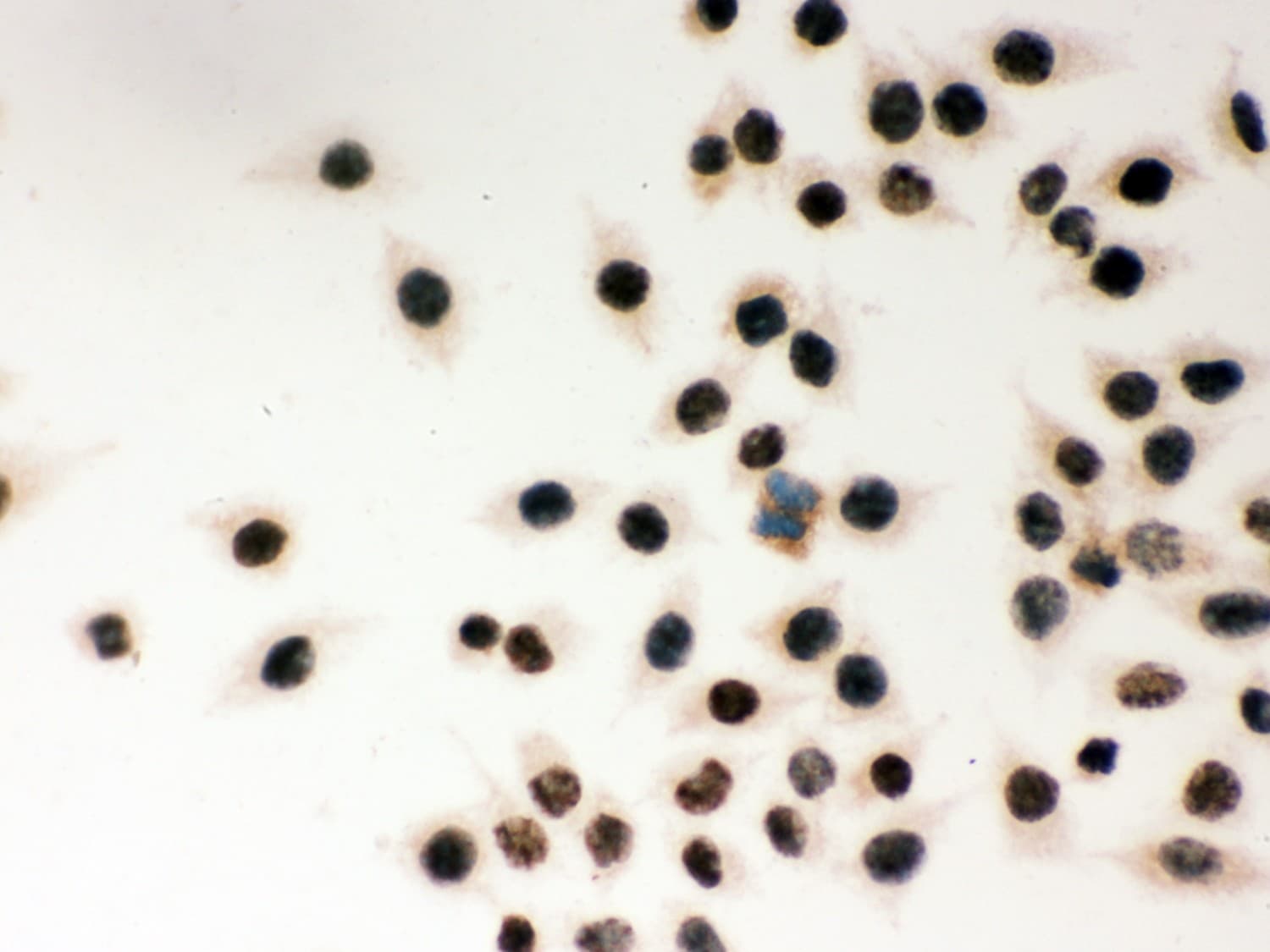 Polyclonal Rabbit anti-Human MSH2 Antibody (aa337-583, IHC, WB)