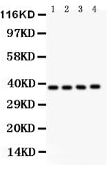Polyclonal Rabbit anti-Human NFKBIB / IKB Beta / IKBB Antibody (aa56-237, IHC, WB)