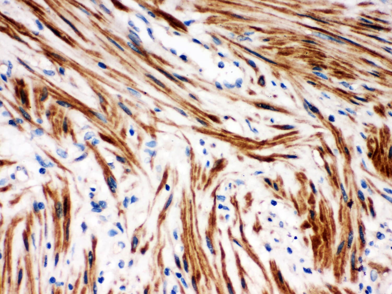 Polyclonal Rabbit anti-Human NFKBIB / IKB Beta / IKBB Antibody (aa56-237, IHC, WB)