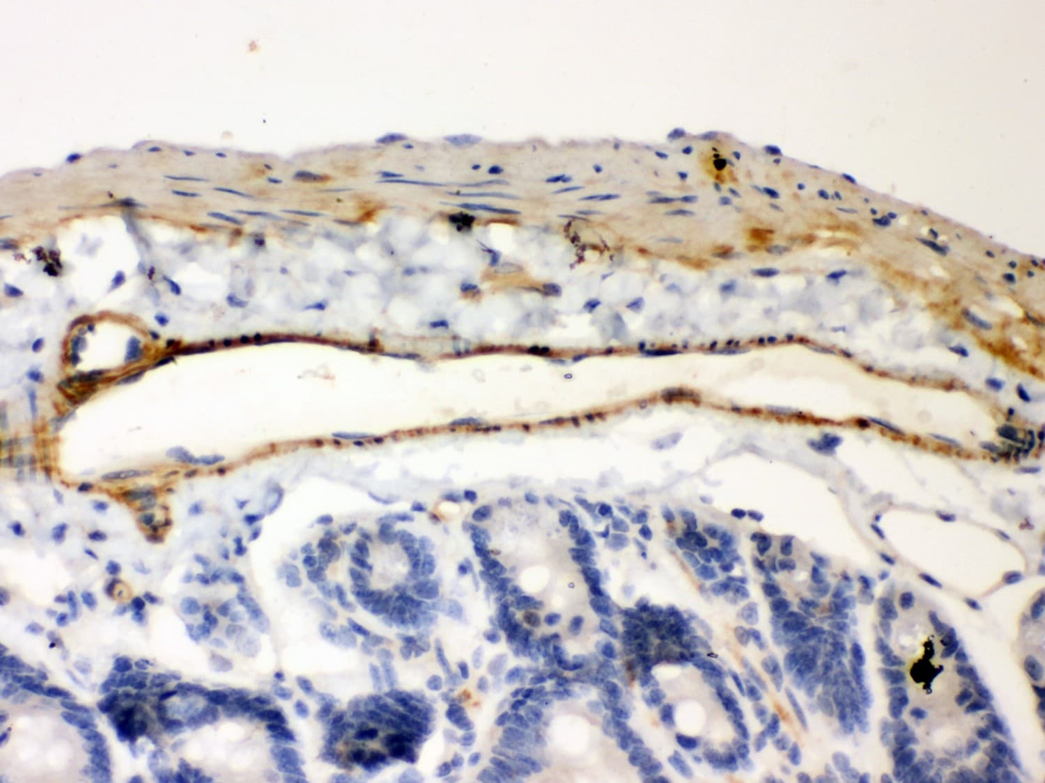 Polyclonal Rabbit anti-Human NFKBIB / IKB Beta / IKBB Antibody (aa56-237, IHC, WB)