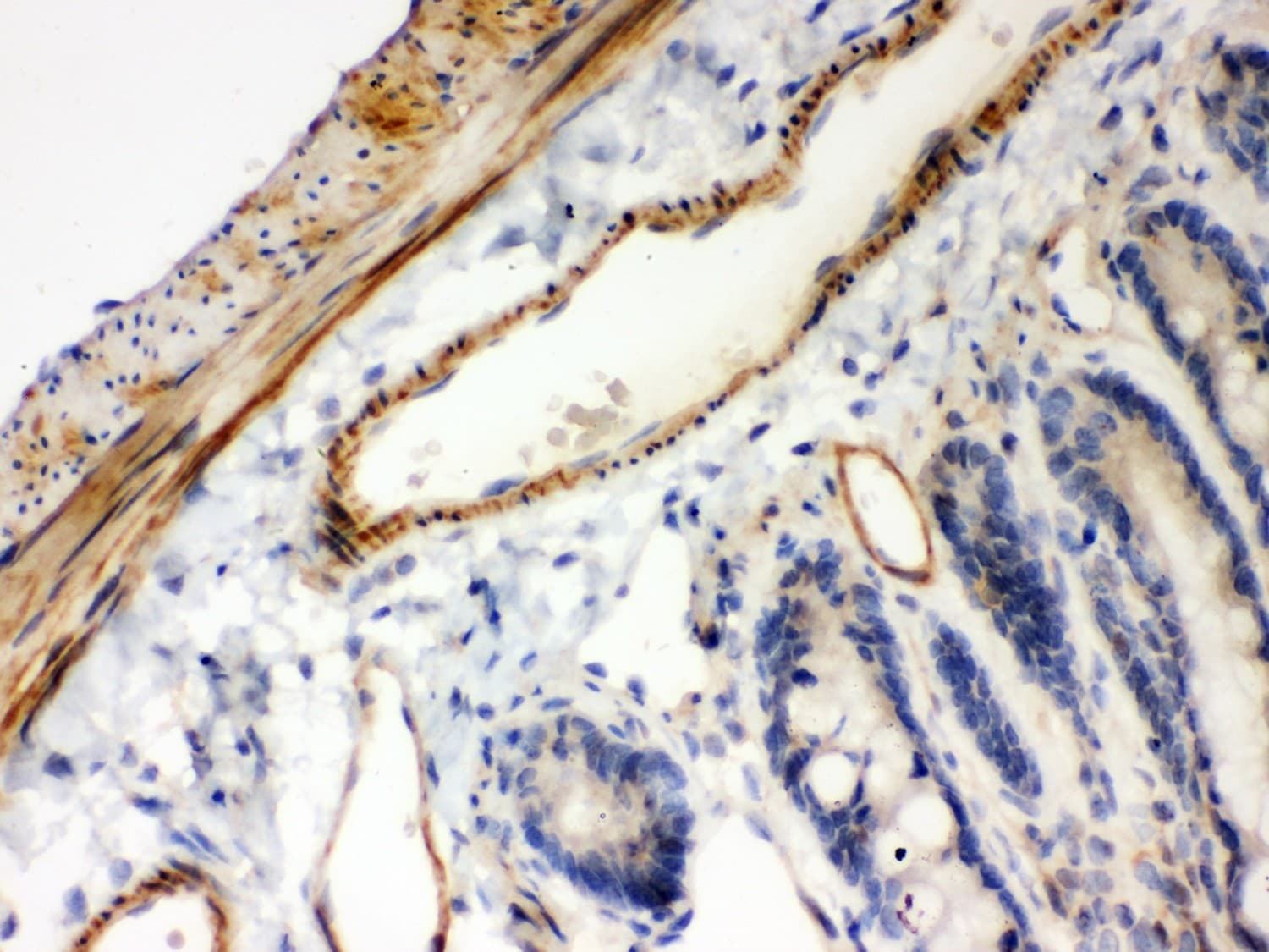 Polyclonal Rabbit anti-Human NFKBIB / IKB Beta / IKBB Antibody (aa56-237, IHC, WB)