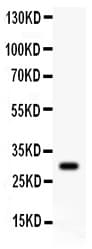 Polyclonal Rabbit anti-Human Neuropeptide Y / NPY Antibody (aa29-64, IHC, WB)