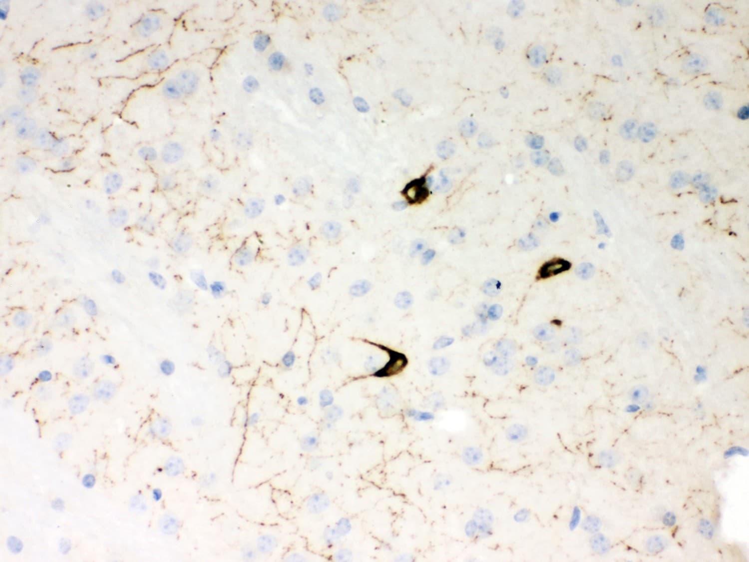 Polyclonal Rabbit anti-Human Neuropeptide Y / NPY Antibody (aa29-64, IHC, WB)