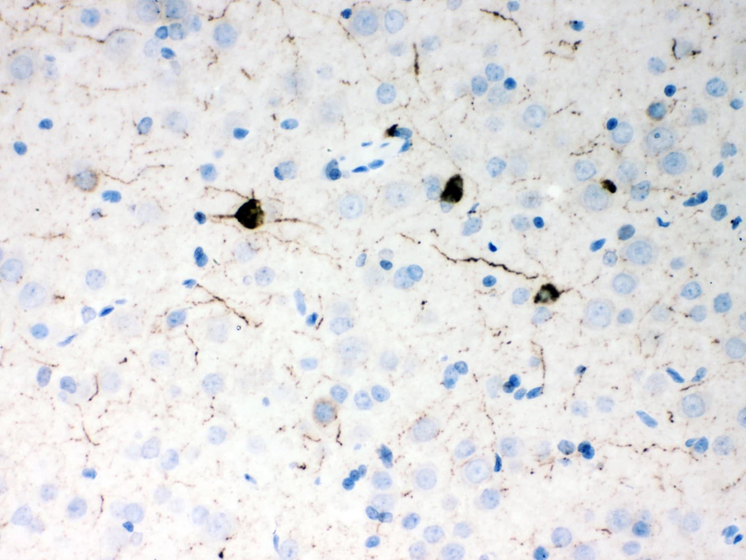 Polyclonal Rabbit anti-Human Neuropeptide Y / NPY Antibody (aa29-64, IHC, WB)