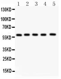 Polyclonal Rabbit anti-Human NR5A2 / LRH-1 Antibody (aa44-237, WB)