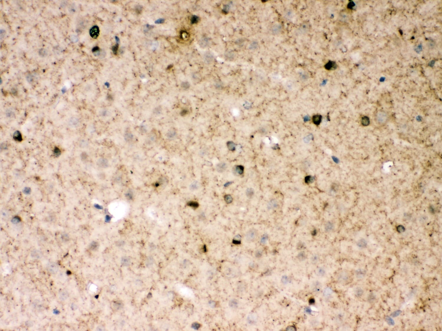 Polyclonal Rabbit anti-Human PARK2 / Parkin 2 Antibody (aa23-416, IHC, WB)