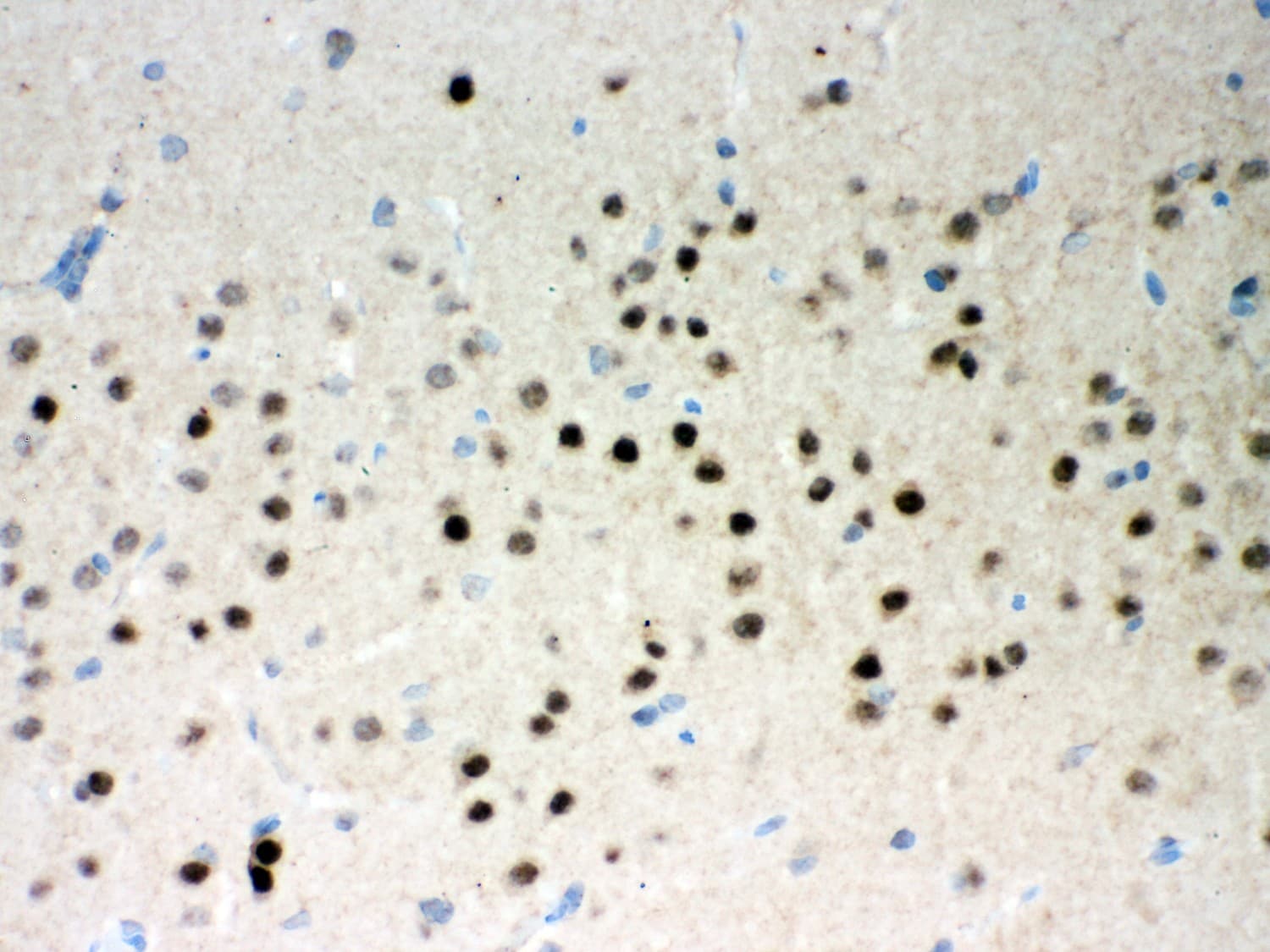 Polyclonal Rabbit anti-Human PARK2 / Parkin 2 Antibody (aa23-416, IHC, WB)