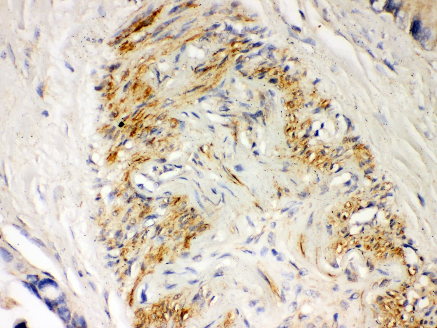 Polyclonal Rabbit anti-Human PARK2 / Parkin 2 Antibody (aa23-416, IHC, WB)