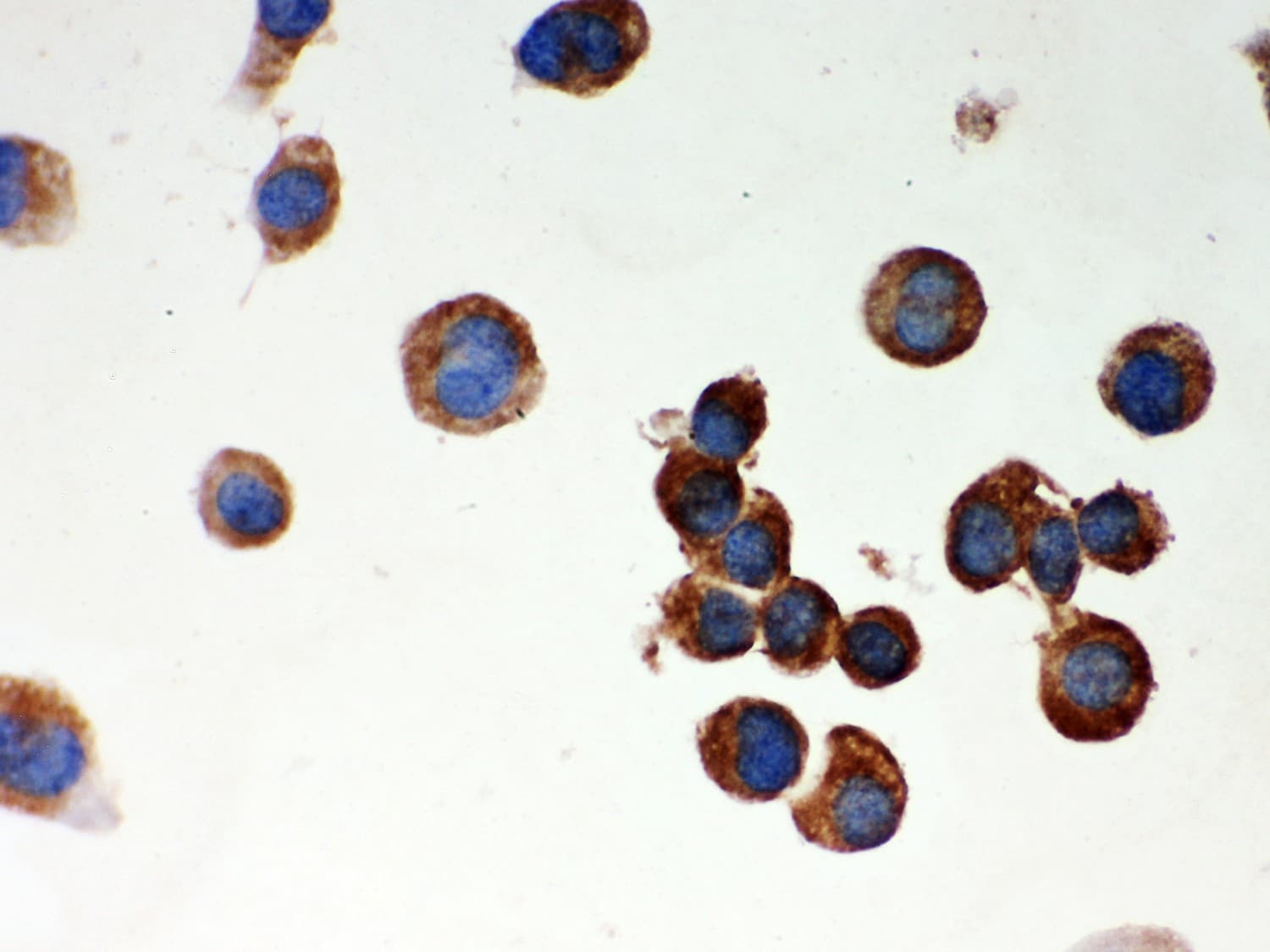 Polyclonal Rabbit anti-Human PARK2 / Parkin 2 Antibody (aa23-416, IHC, WB)