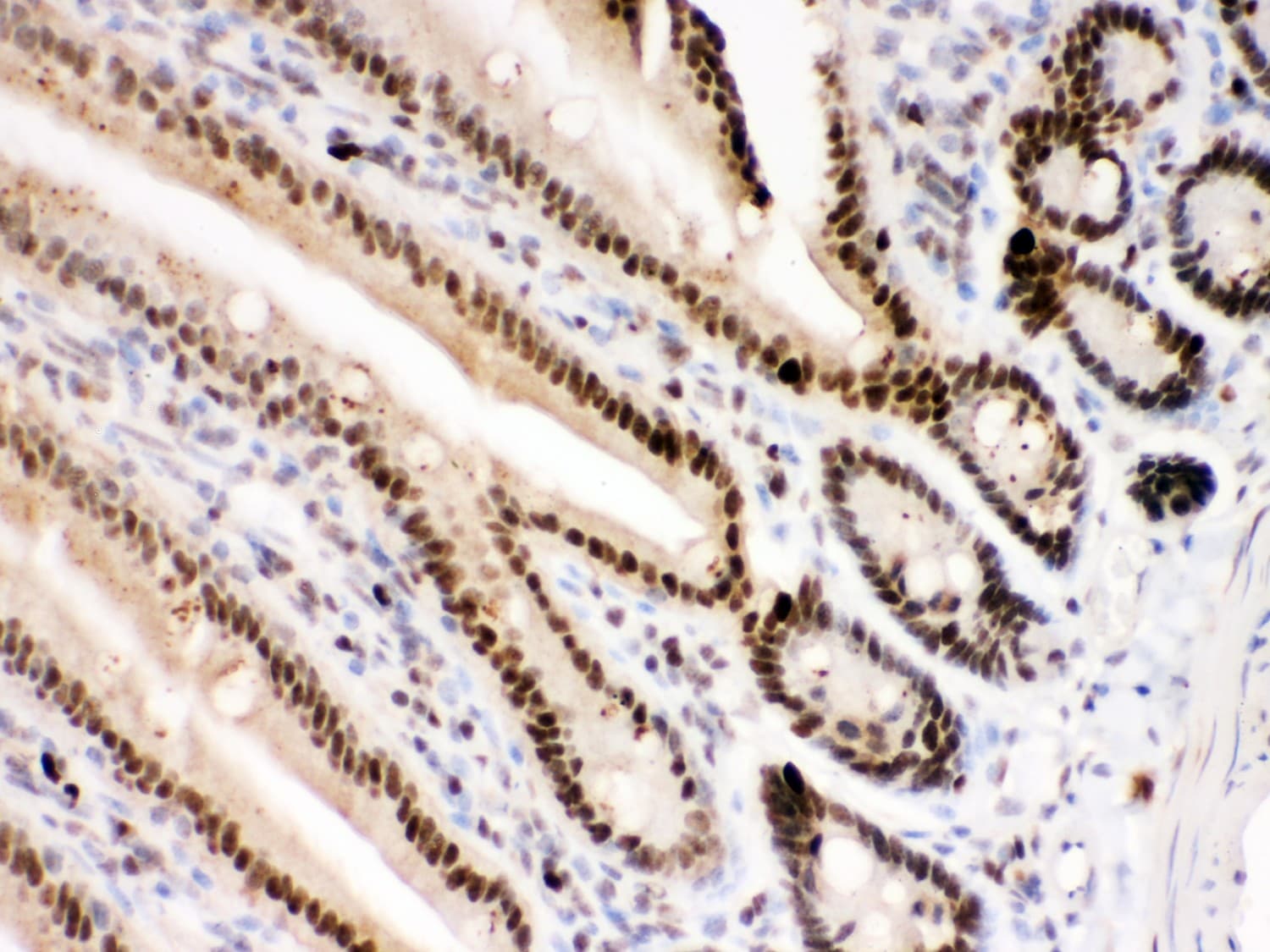 Polyclonal Rabbit anti-Human PARP1 Antibody (aa670-858, IHC, WB)