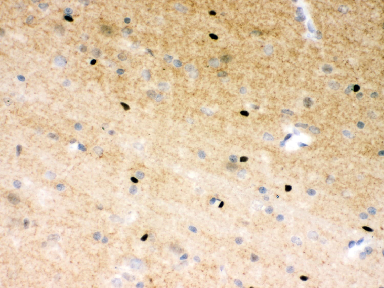Polyclonal Rabbit anti-Human PARP1 Antibody (aa670-858, IHC, WB)