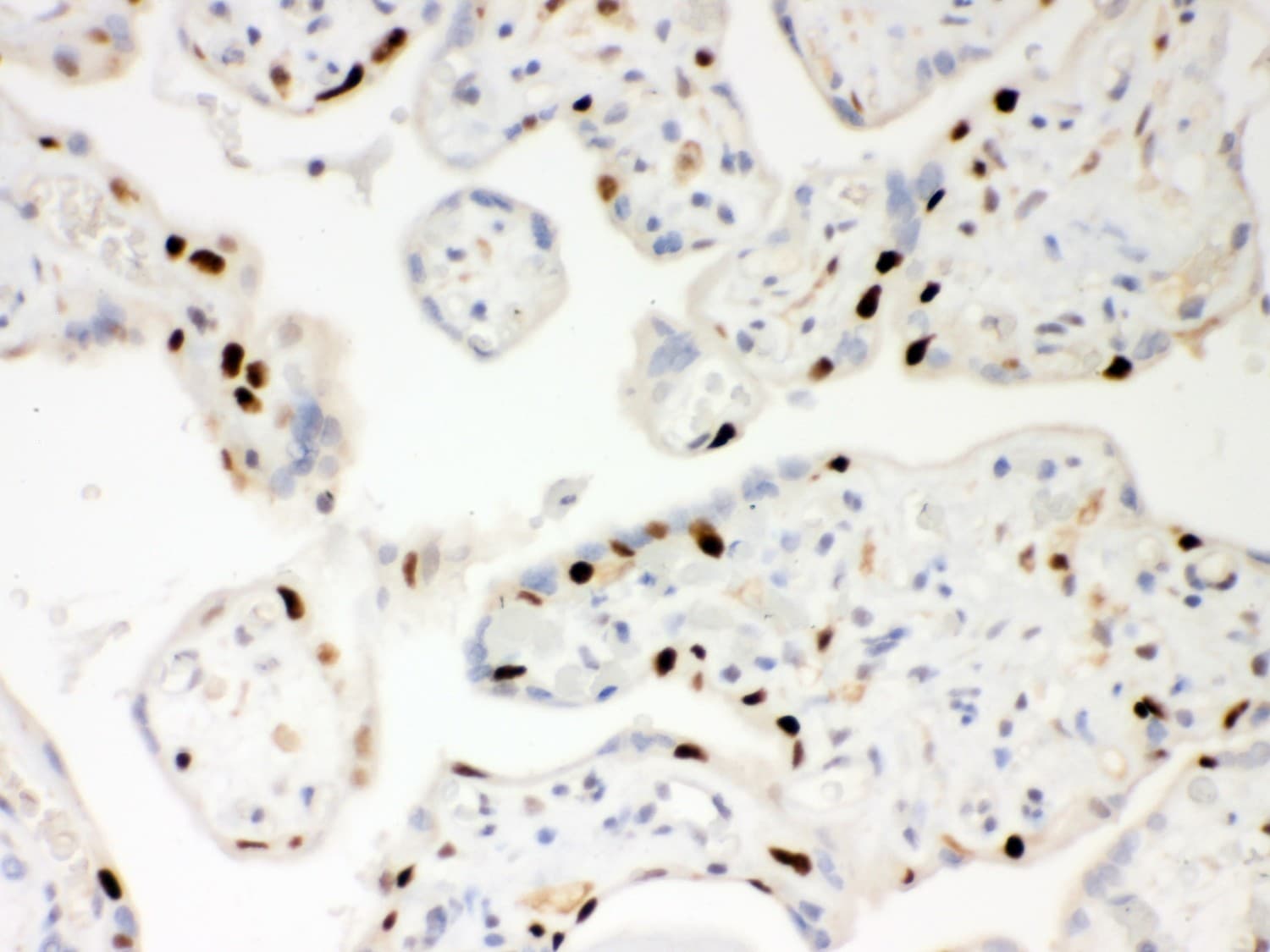 Polyclonal Rabbit anti-Human PARP1 Antibody (aa670-858, IHC, WB)