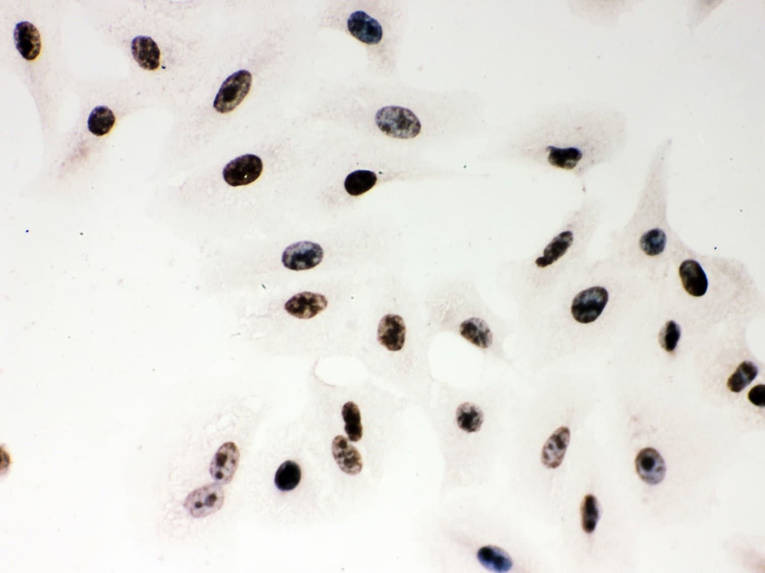 Polyclonal Rabbit anti-Human PARP1 Antibody (aa670-858, IHC, WB)