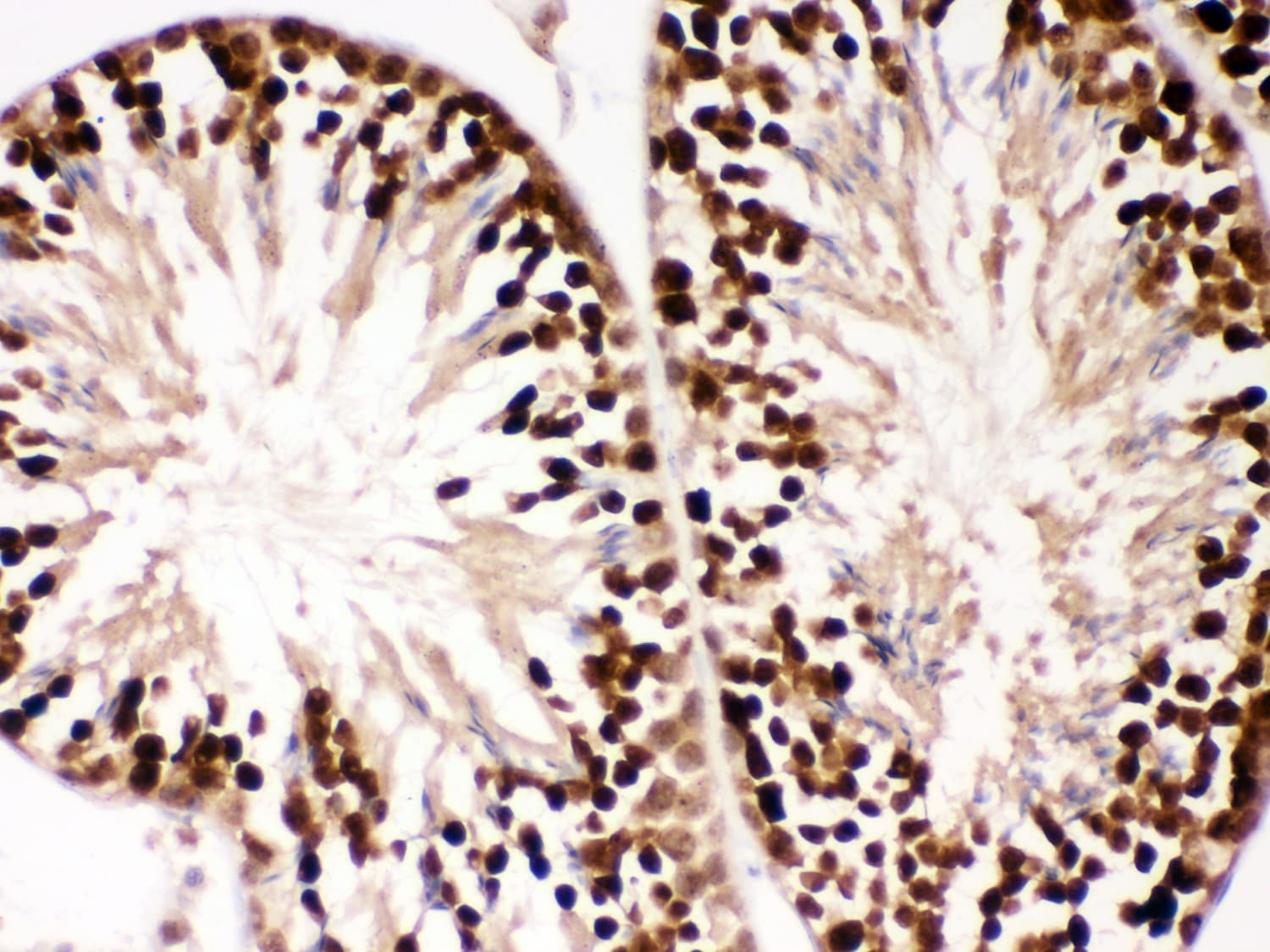 Polyclonal Rabbit anti-Human PBK / TOPK Antibody (aa71-322, IHC, WB)