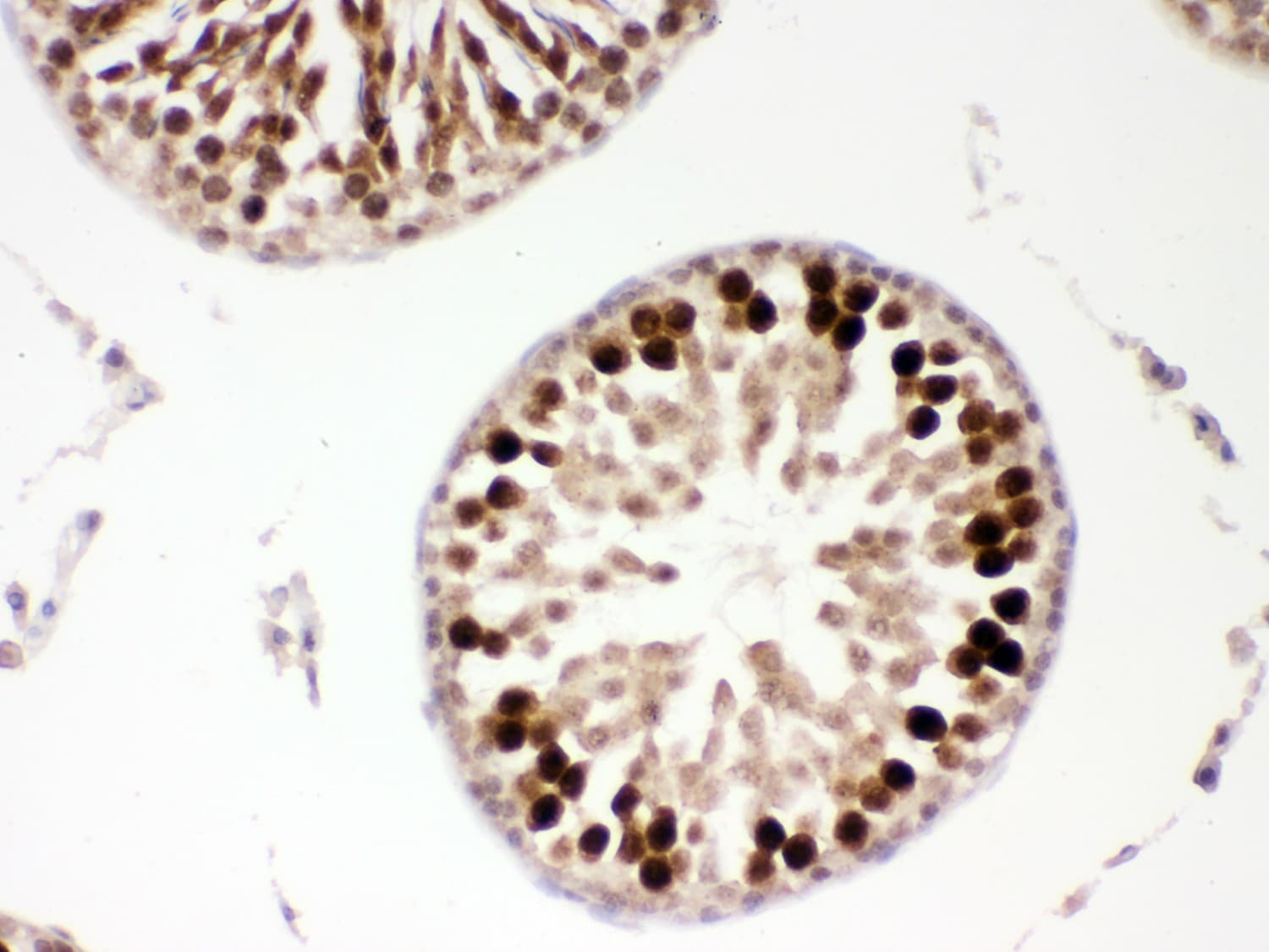 Polyclonal Rabbit anti-Human PBK / TOPK Antibody (aa71-322, IHC, WB)