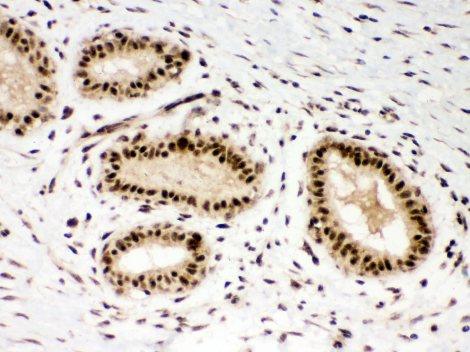 Polyclonal Rabbit anti-Human PBK / TOPK Antibody (aa71-322, IHC, WB)