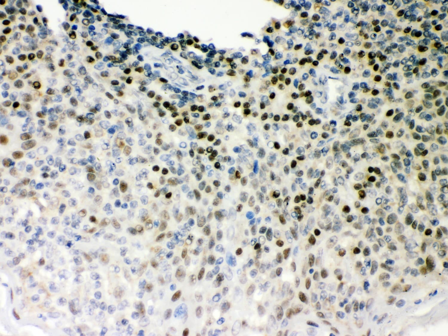 Polyclonal Rabbit anti-Human POU2F1 / OCT1 Antibody (aa11-240, IHC, WB)