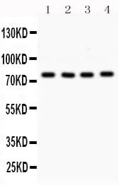 PRKCA / PKC-Alpha Antibody (aa153-342)