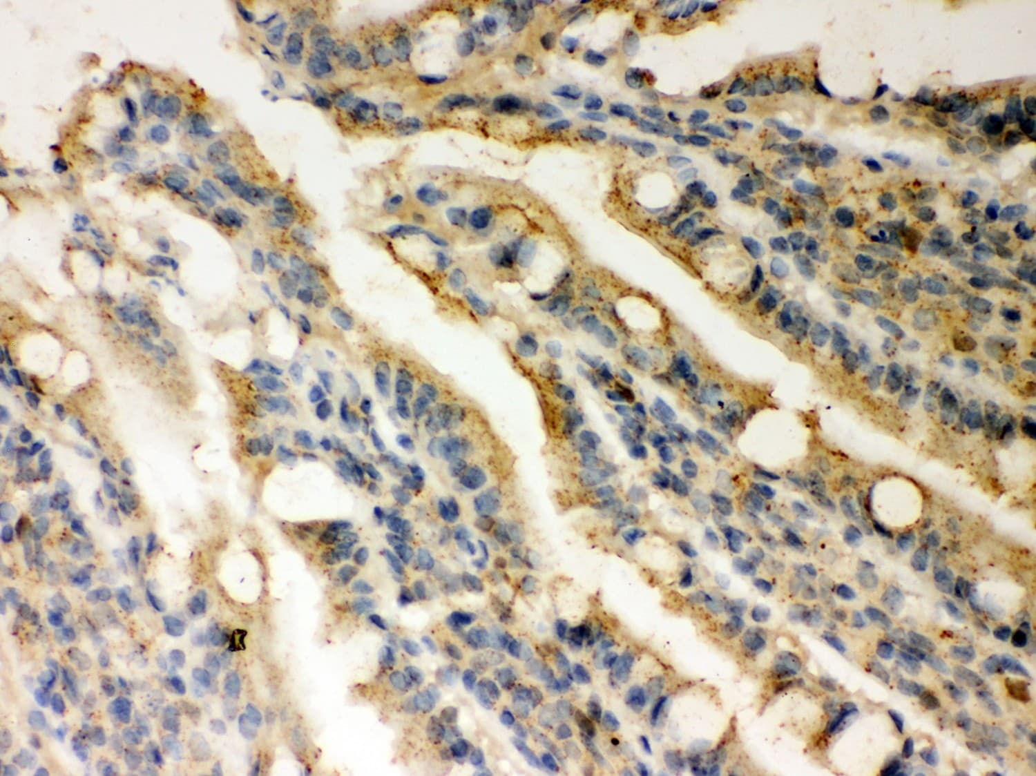 Polyclonal Rabbit anti-Human RAD51 / RECA Antibody (aa1-258, IHC, WB)