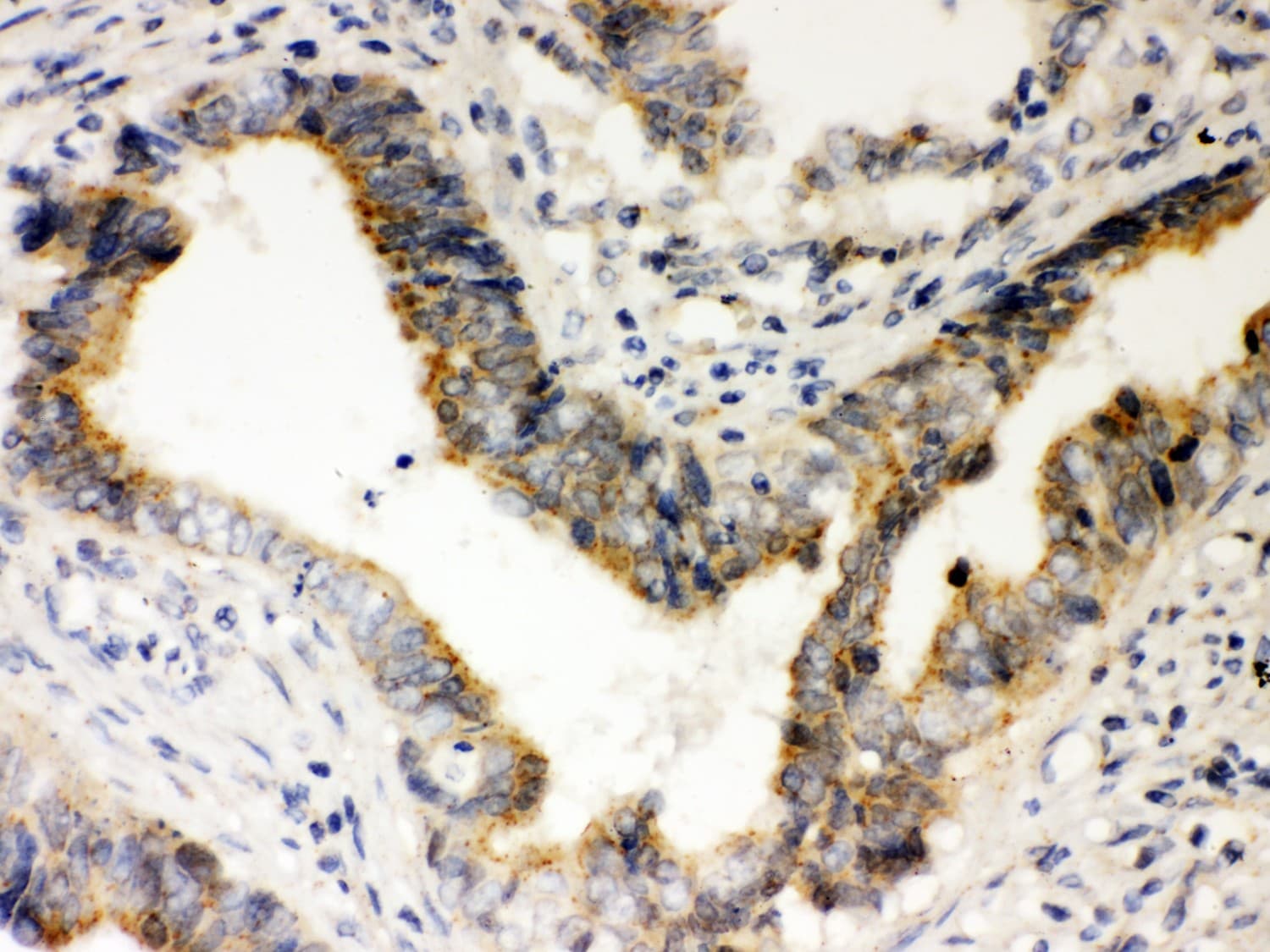 Polyclonal Rabbit anti-Human RAD51 / RECA Antibody (aa1-258, IHC, WB)