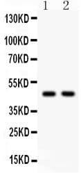 Polyclonal Rabbit anti-Human SERPINH1 / HSP47 Antibody (aa247-418, IHC, WB)