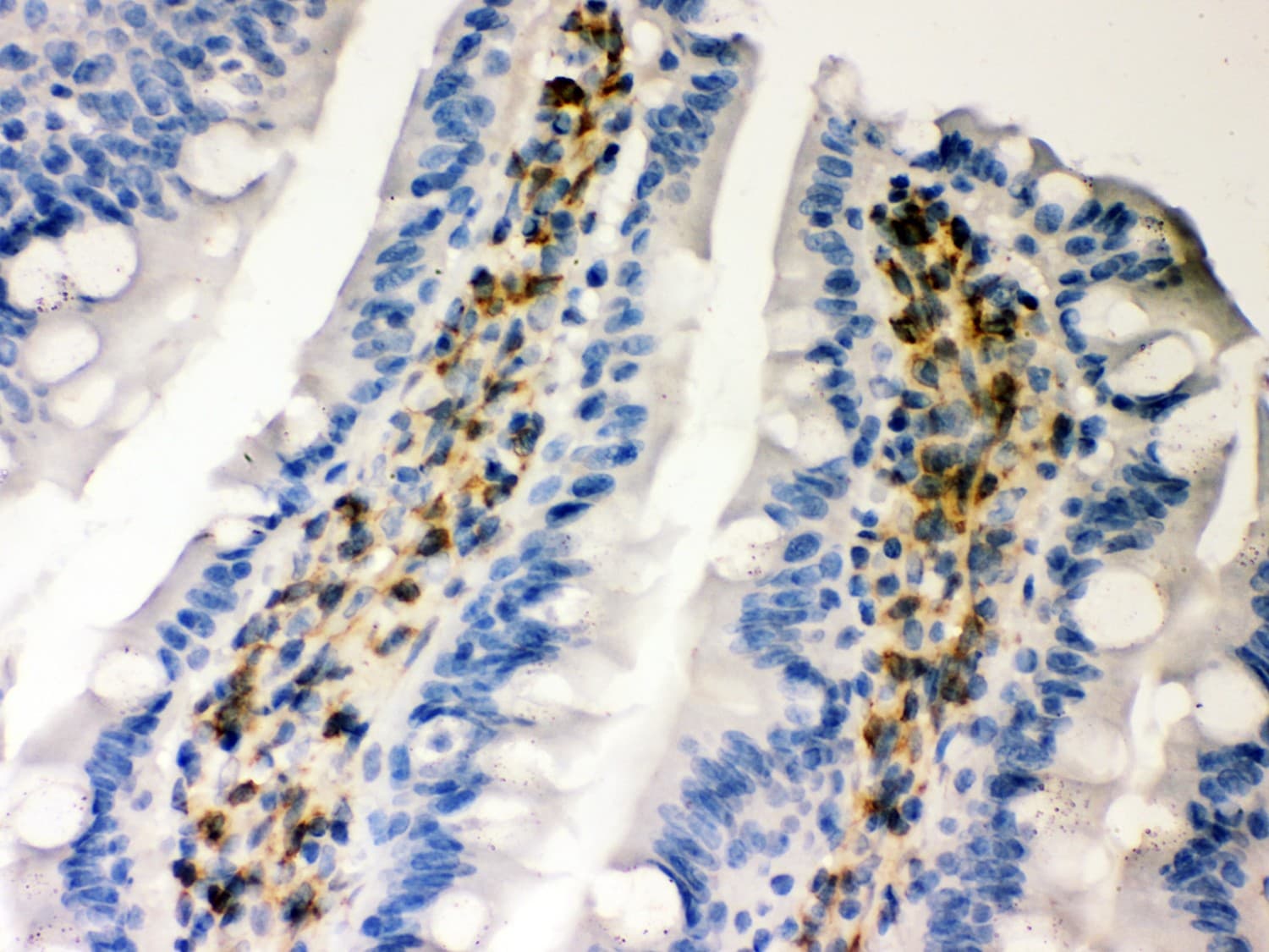Polyclonal Rabbit anti-Human SERPINH1 / HSP47 Antibody (aa247-418, IHC, WB)