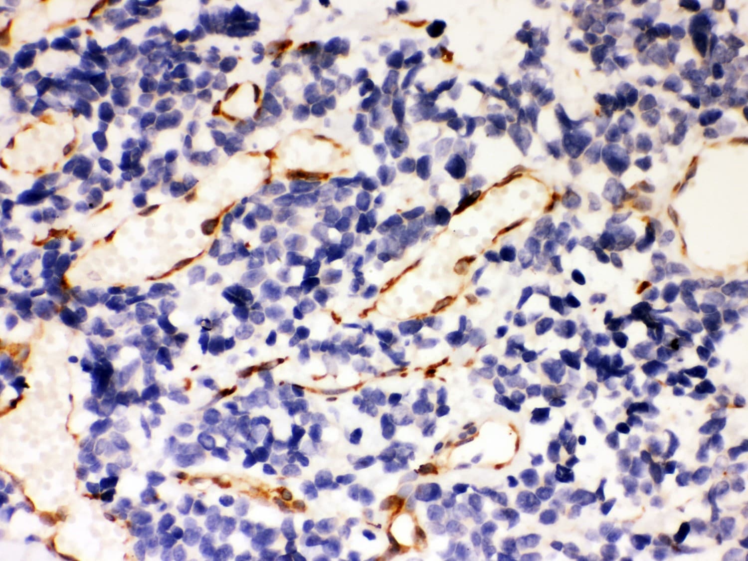 Polyclonal Rabbit anti-Human SERPINH1 / HSP47 Antibody (aa247-418, IHC, WB)
