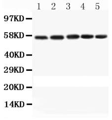 CASP8 / Caspase 8 Antibody (aa388-480)
