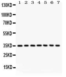 CASP9 / Caspase 9 Antibody (aa3-228)