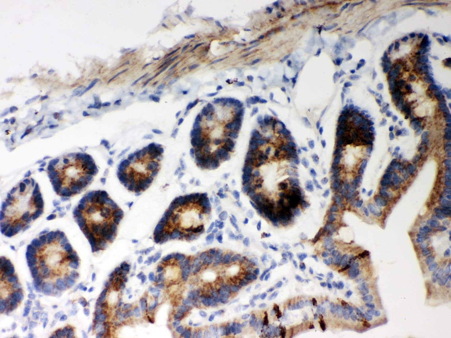 HSPD1 / HSP60 Antibody (aa260-496)