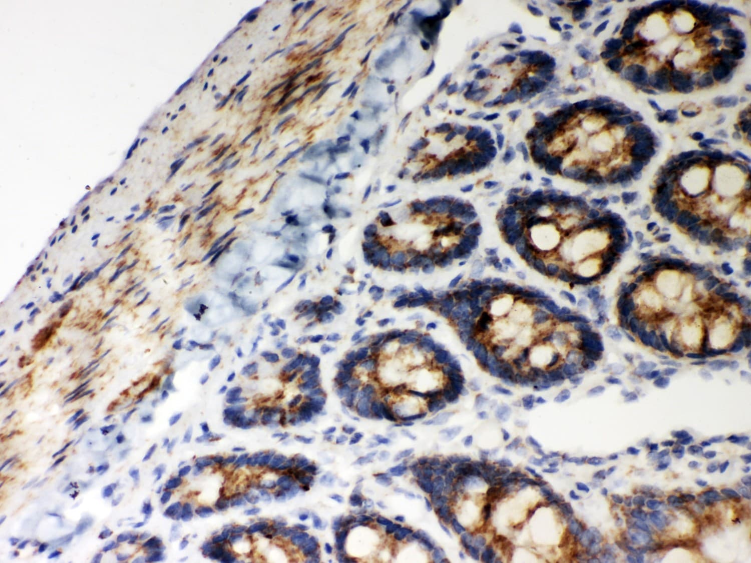 HSPD1 / HSP60 Antibody (aa260-496)