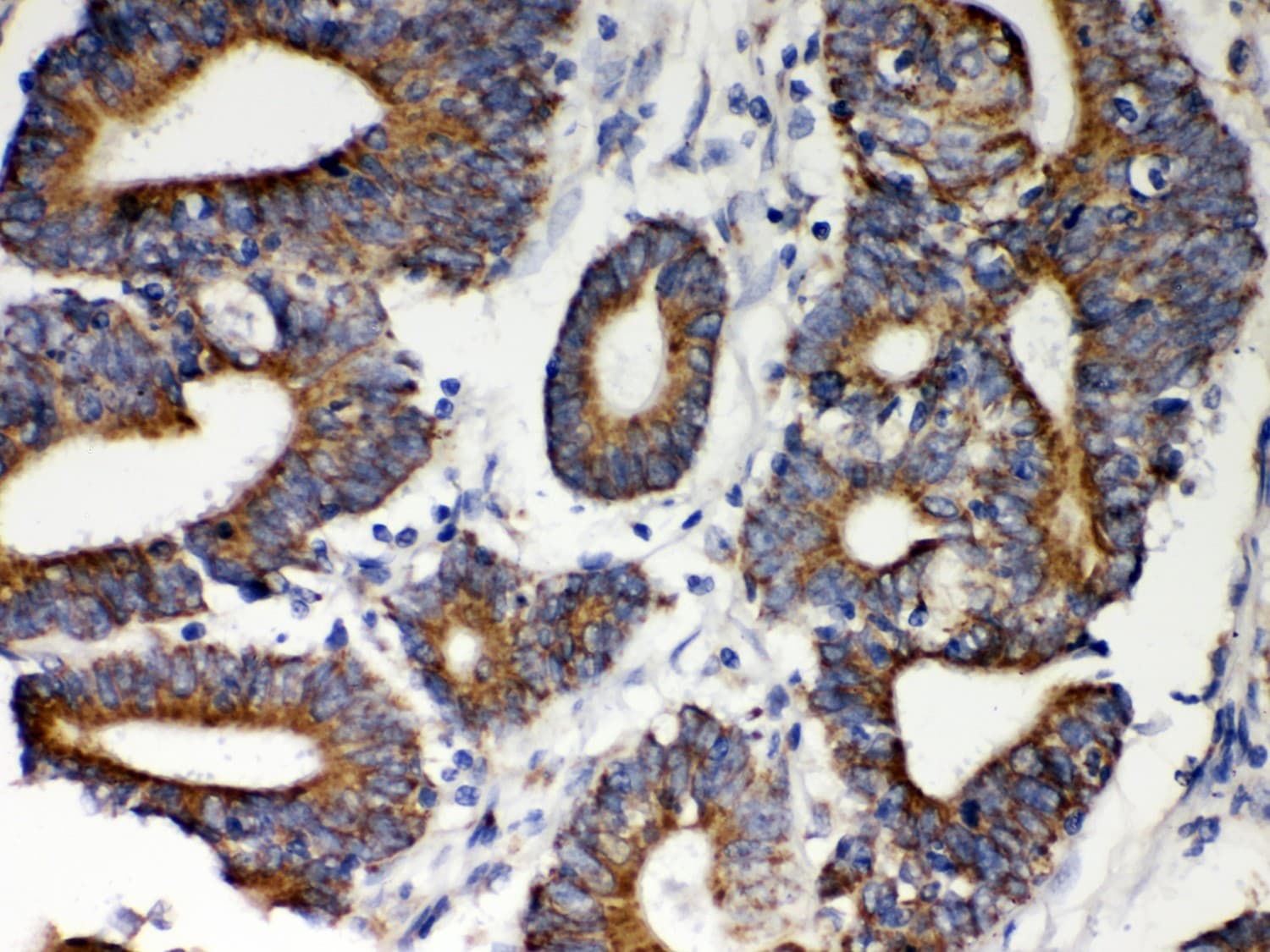 HSPD1 / HSP60 Antibody (aa260-496)