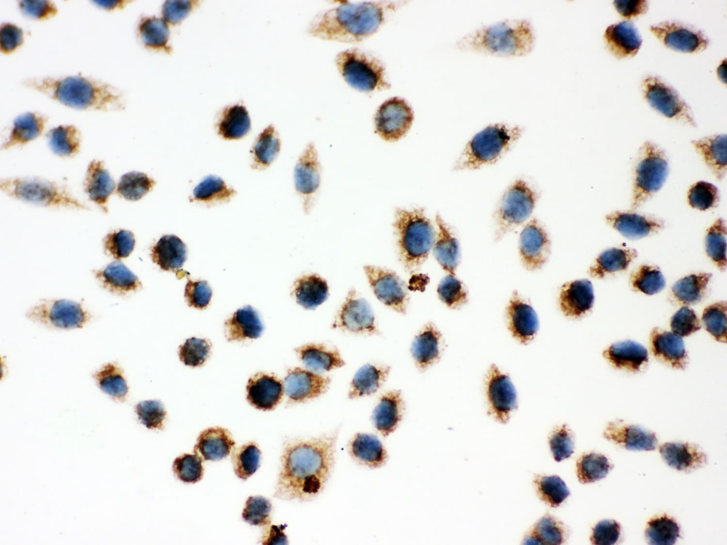 HSPD1 / HSP60 Antibody (aa260-496)