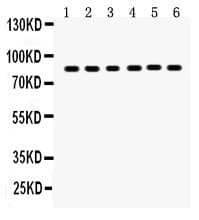PLAT / TPA Antibody (aa366-562)