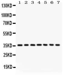 Polyclonal Rabbit anti-Human PP2Ac / PPP2CA Antibody (aa1-309, IHC, WB)