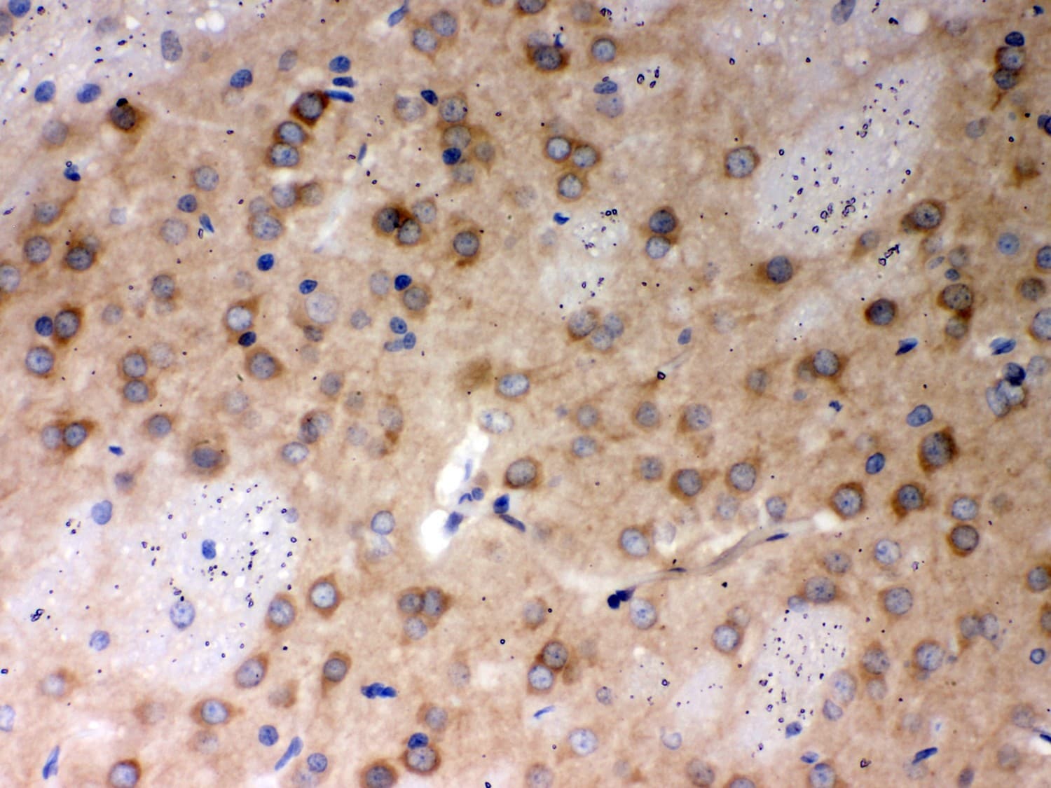 Polyclonal Rabbit anti-Human PP2Ac / PPP2CA Antibody (aa1-309, IHC, WB)