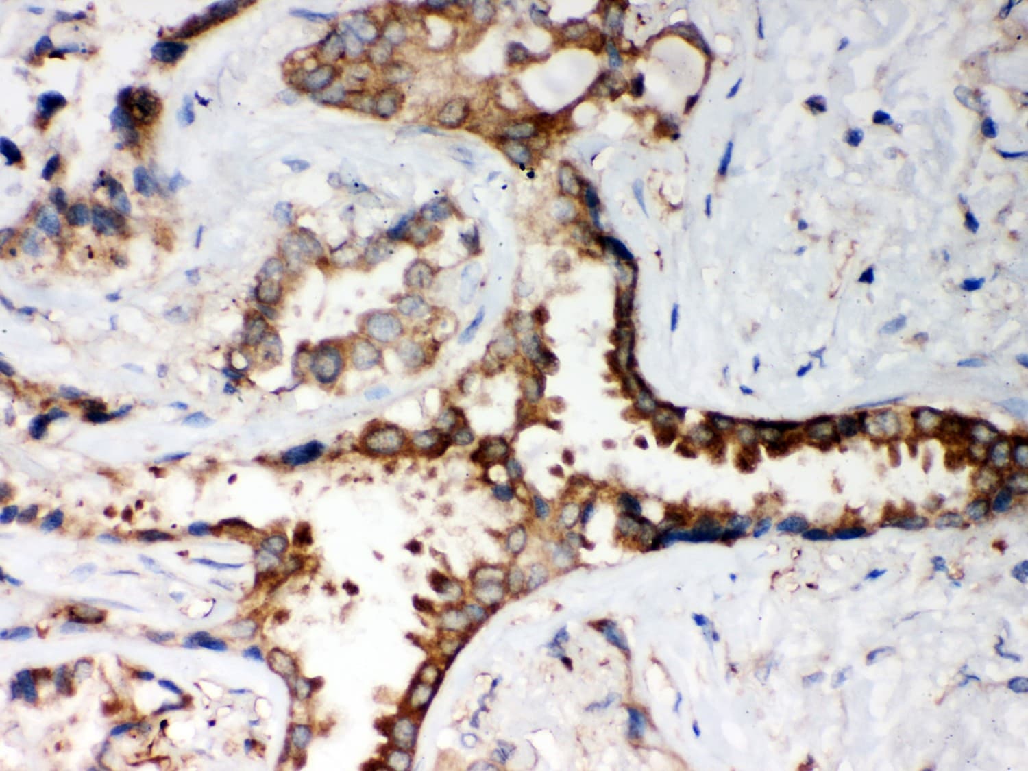 Polyclonal Rabbit anti-Human PP2Ac / PPP2CA Antibody (aa1-309, IHC, WB)