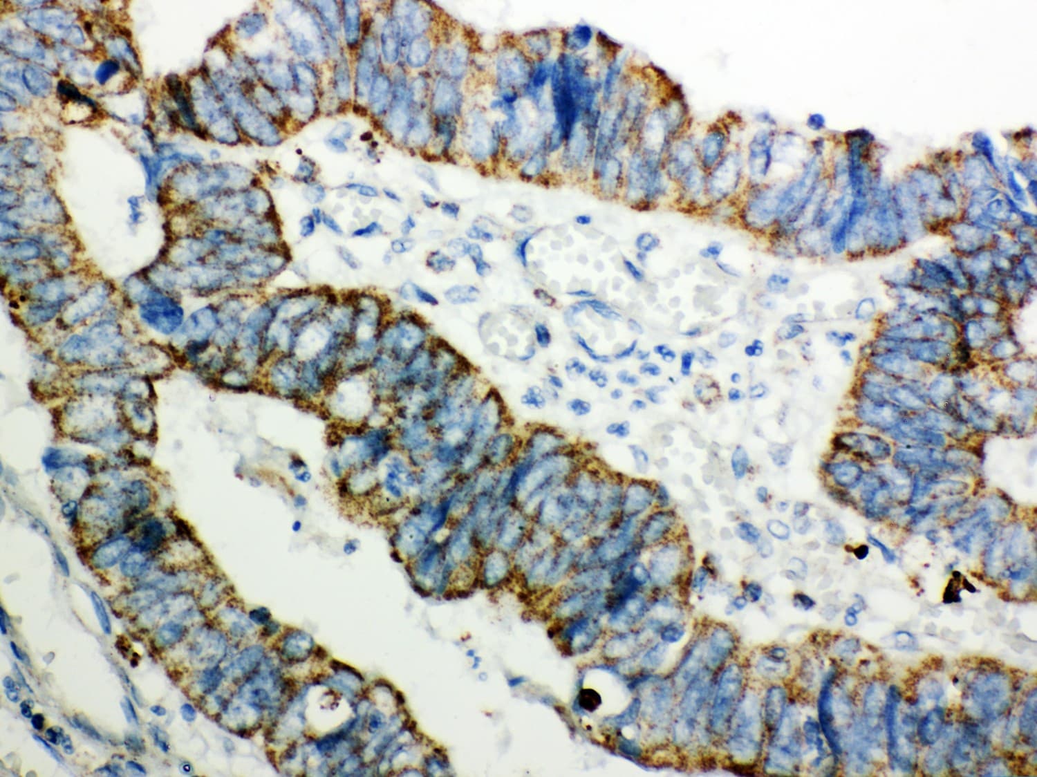 Polyclonal Rabbit anti-Human PRDX3 / Peroxiredoxin 3 Antibody (aa110-256, IHC, WB)
