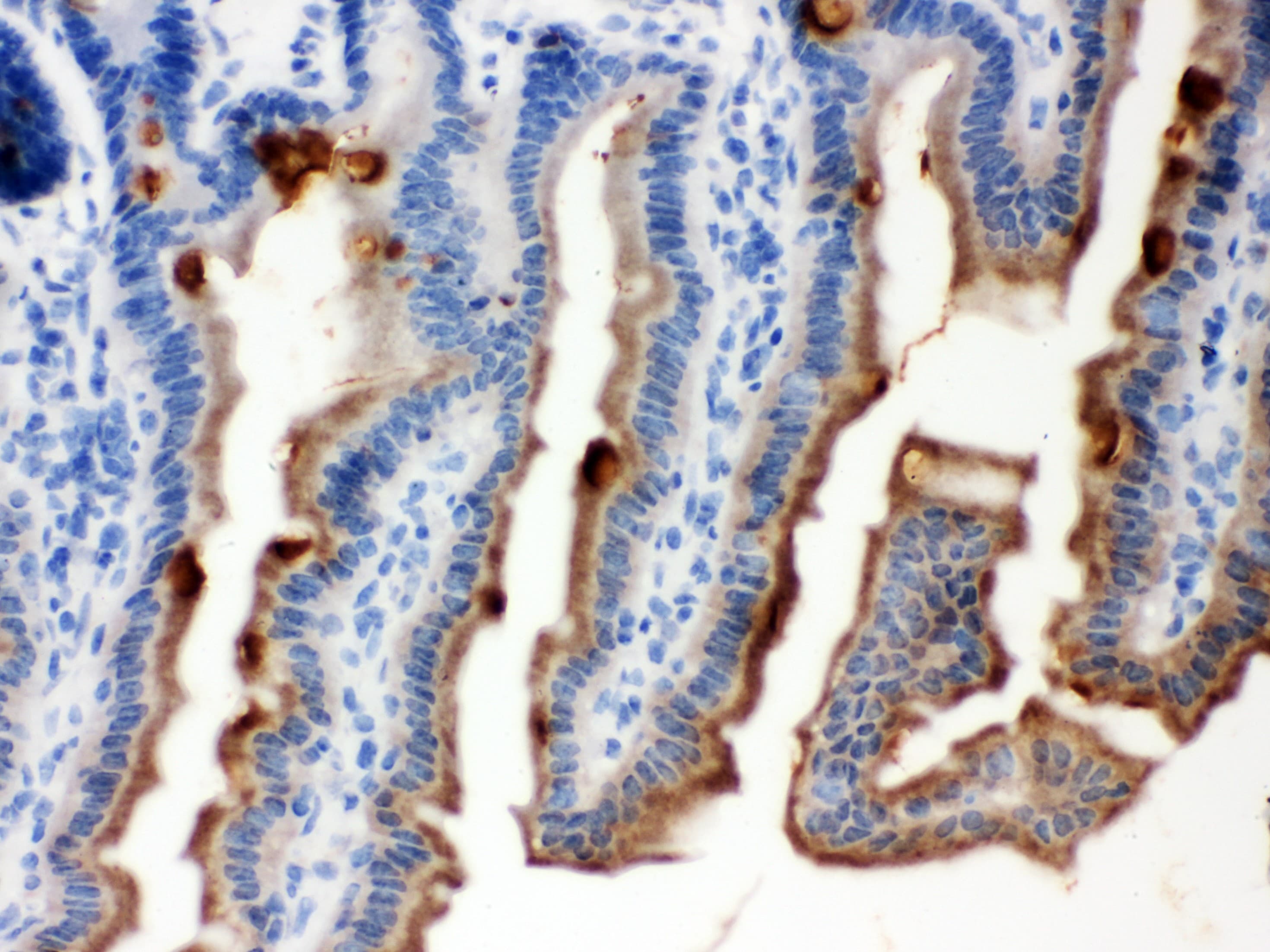Polyclonal Rabbit anti-Human SERPINB5 / Maspin Antibody (aa1-350, IHC, WB)
