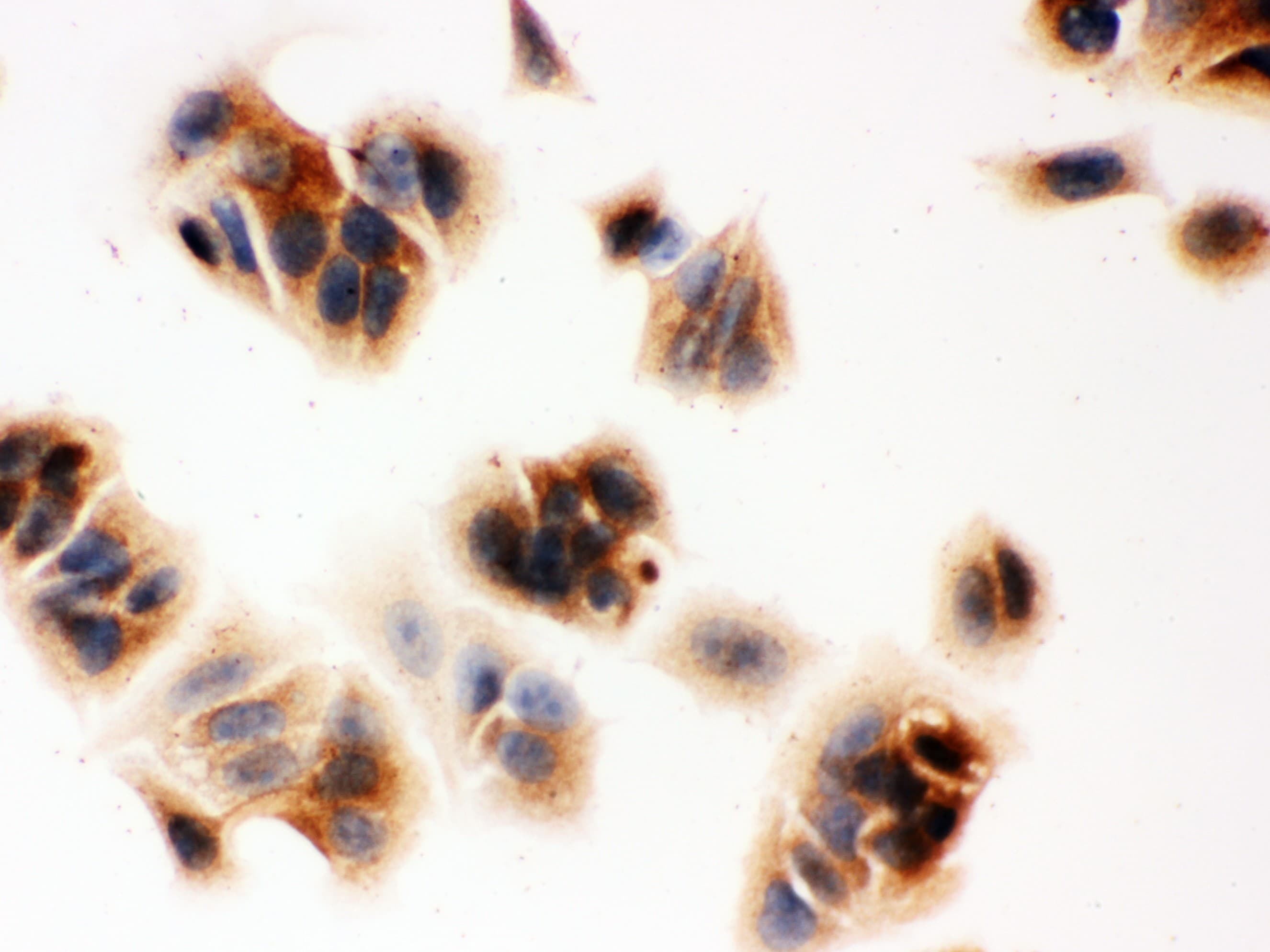 Polyclonal Rabbit anti-Human SERPINB5 / Maspin Antibody (aa1-350, IHC, WB)